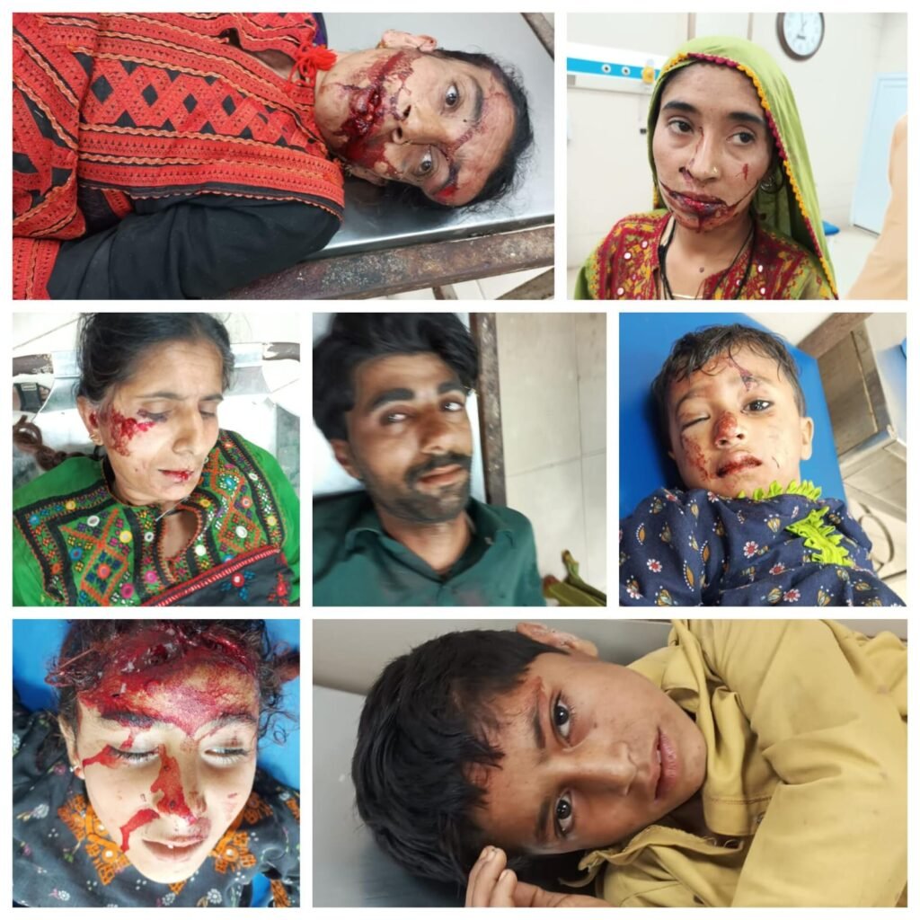 منگھوپیر میں مزدا اور چنچی میں تصادم، 7 افراد زخمی 1 WhatsApp Image 2026 03 16 at 7.01.29 PM