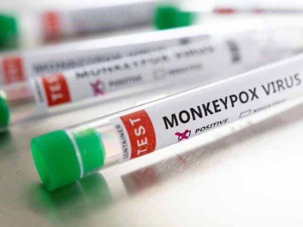 New mpox case reported at an infectious disease hospital in Karachi