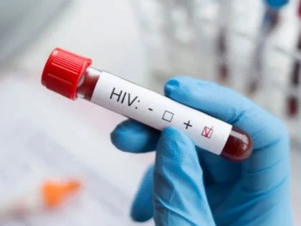 HIV-affected children and families at Valika Hospital Karachi