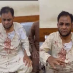 University of Karachi professor Arif Khan Saki after alleged assault near Safora Chowrangi in Karachi