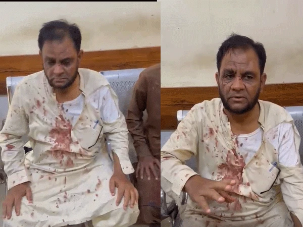 University of Karachi professor Arif Khan Saki after alleged assault near Safora Chowrangi in Karachi